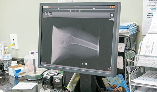 foot and ankle injuries